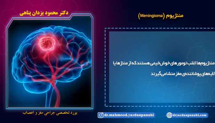تومور مغزی مننژیوما